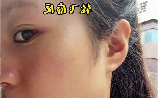 輪飛廓反耳相