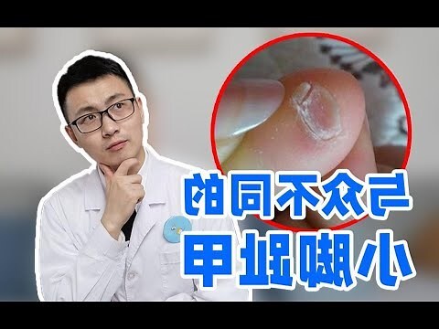 留尾指指甲