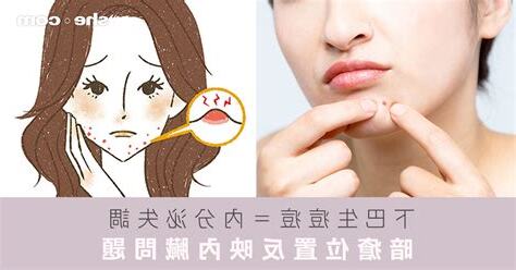 下巴生暗瘡內分泌失調