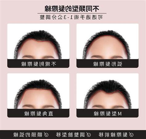 髮際線面相