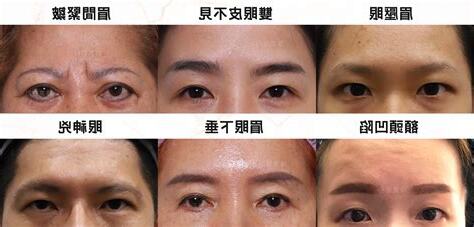 眉壓眼外國人