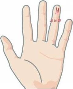 食指橫紋