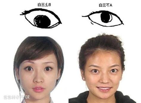 上三白意思