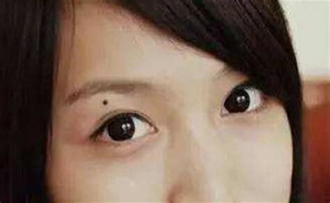 左眼上有痣