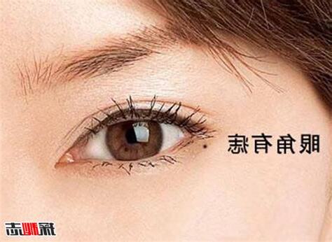眼皮上的痣可以點掉嗎