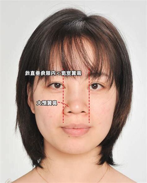 寬鼻翼面相
