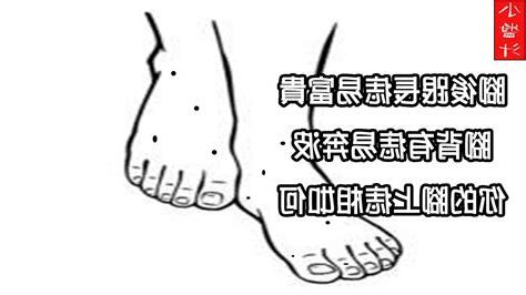 腳背有痣