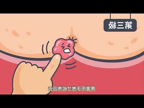 黑痔