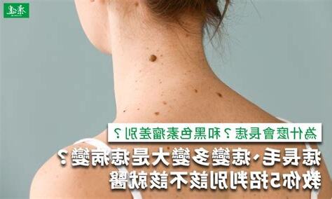 痣突然長毛