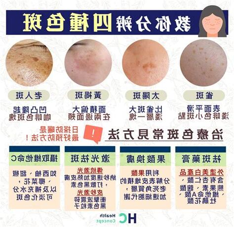 臉頰有斑