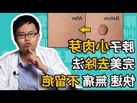 脖子突然長痣