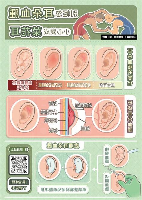 耳朵軟骨受傷