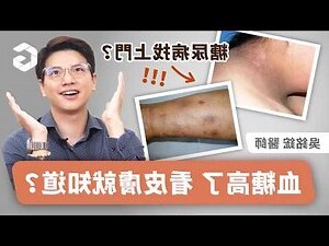 臉上長黑斑