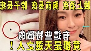 胸長痣
