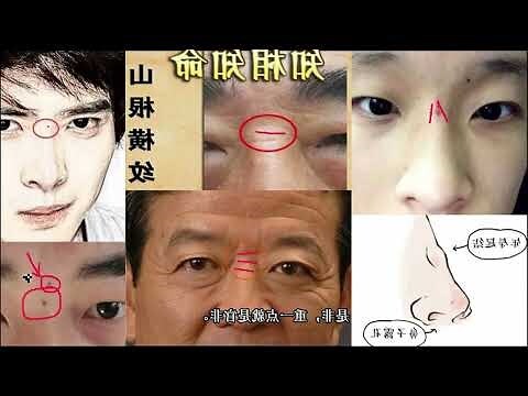 鼻根有痣
