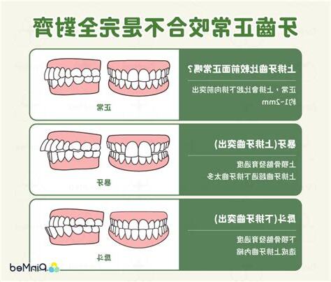 上排牙齒突出正常嗎