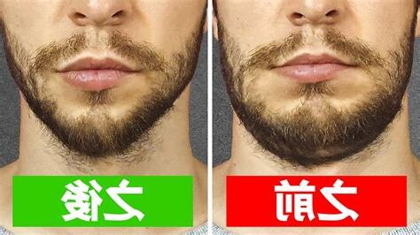下巴長一根鬍子