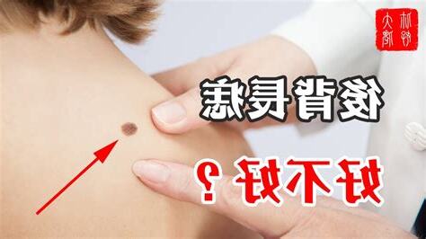 背長痣