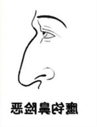 鷹勾鼻面相