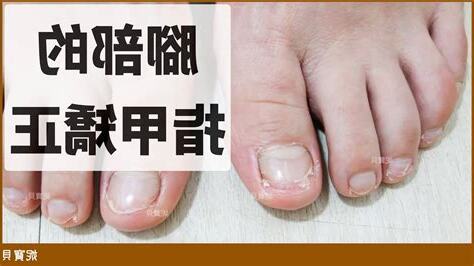 沒有腳指甲