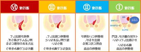 長痔