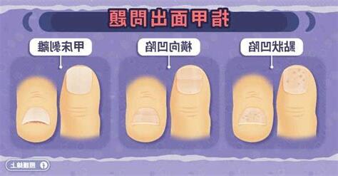 指甲中間凹下去