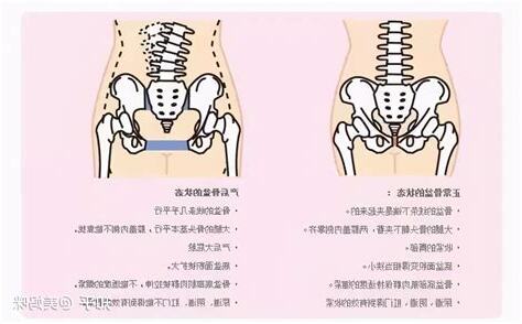 骨盆有痣