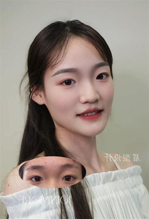 眉心長毛