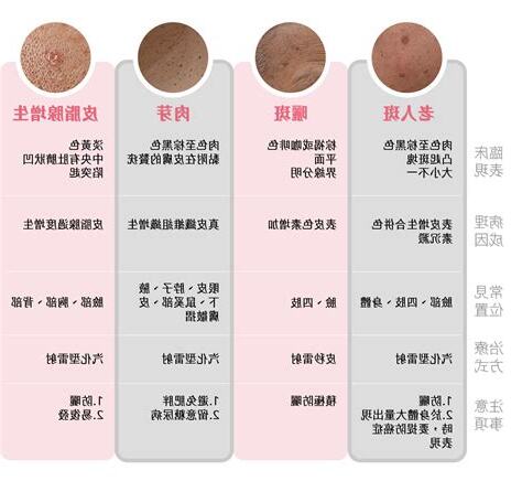 班點人
