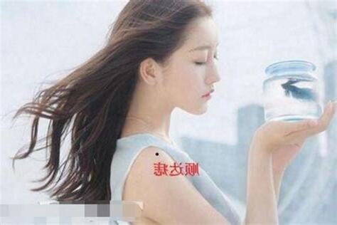 大方痣