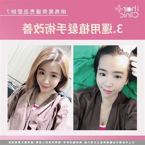 綁馬尾旁邊禿