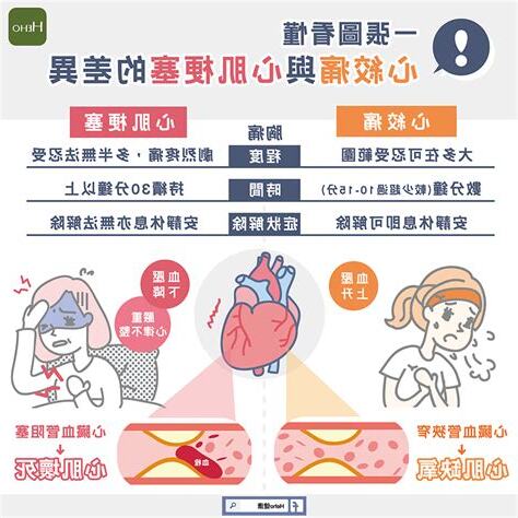 心絞痛位置