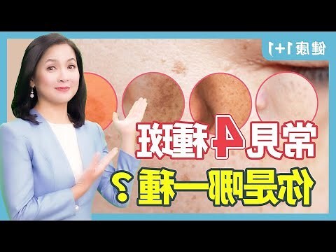 臉部有斑