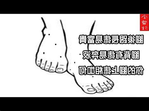 右腳踝有痣