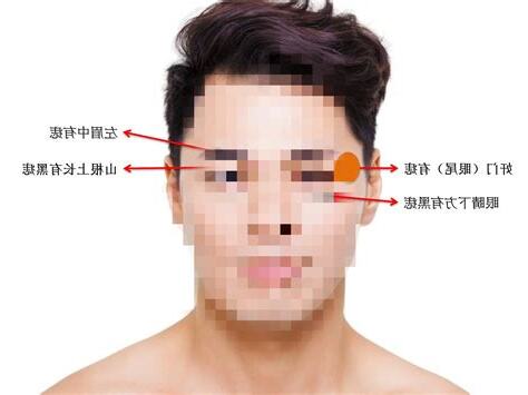 左眉有痣男