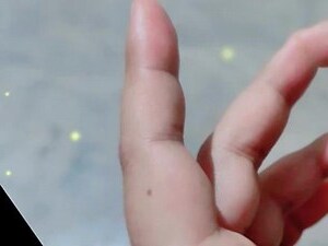 左食指有痣