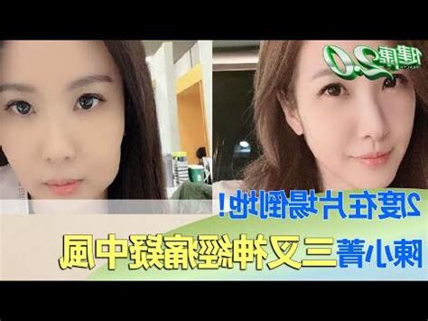 左邊臉痛