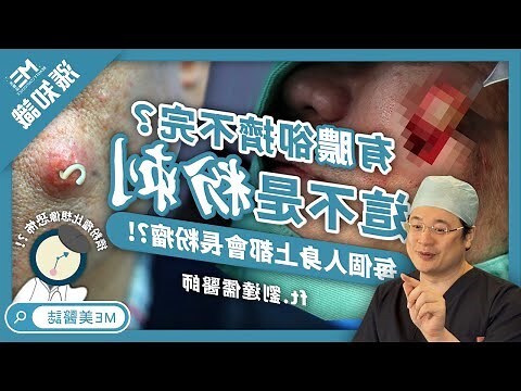 耳垂長痘痘看哪科
