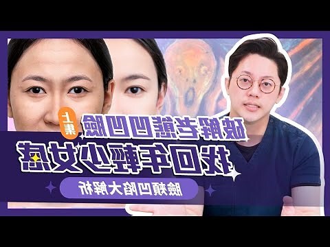 额头凹陷