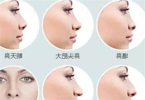 旺夫女人鼻型面相
