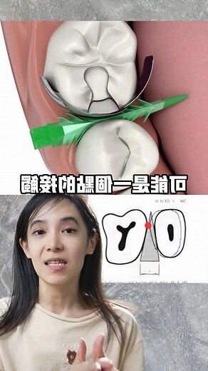 牙縫大面相