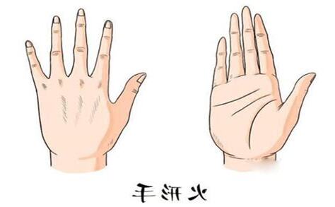 火形手