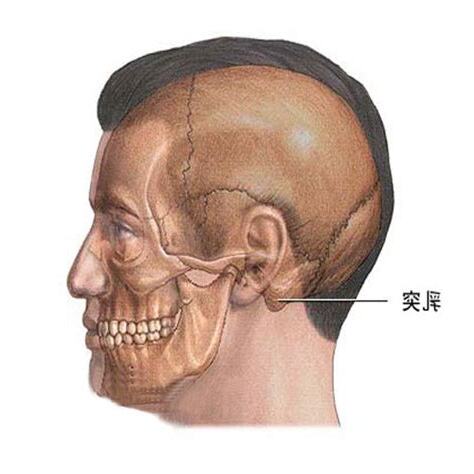乳突骨突出
