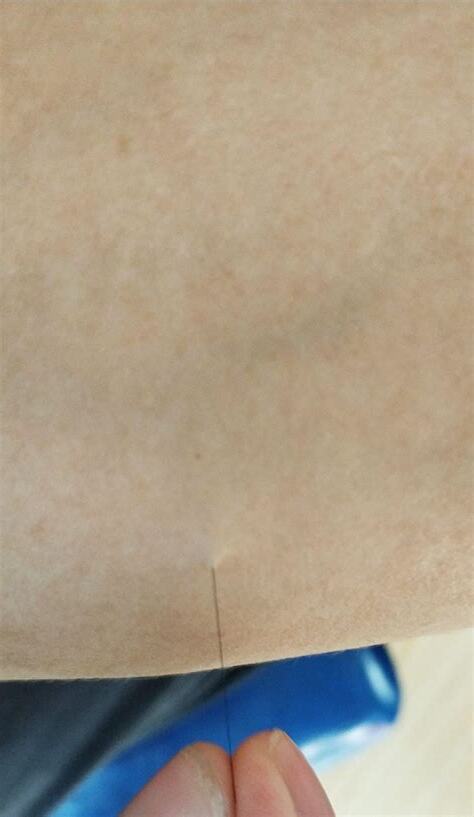 手臂突然長一根很長的白毛