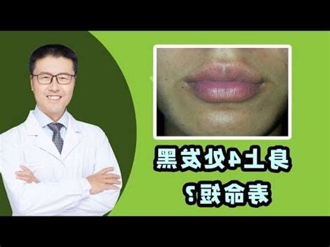 鼻頭發黑