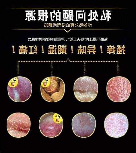 龟头黑点