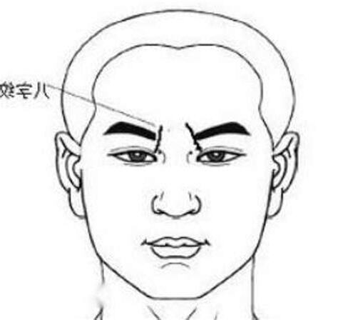 額頭八字紋