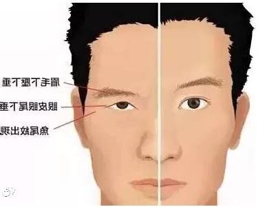 三角眼男人面相