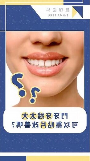 門牙大