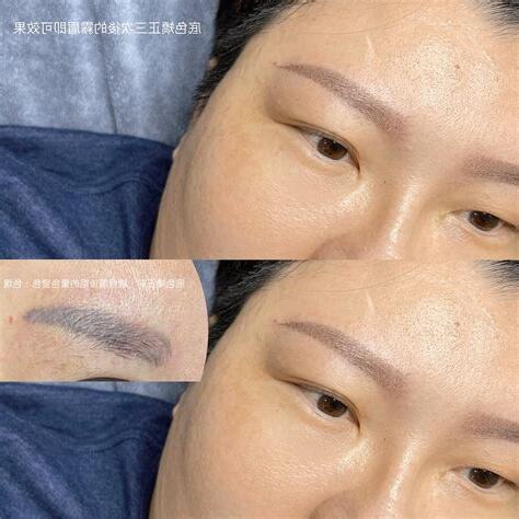 霧眉改變命運